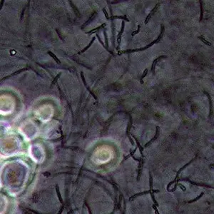 yeast and bacteria