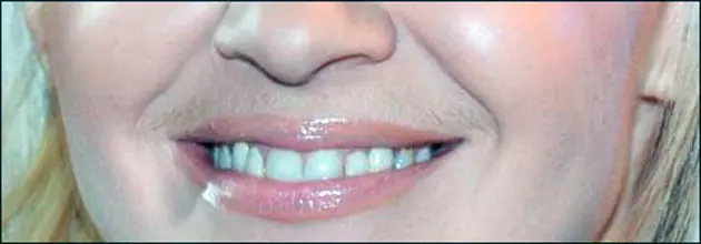 mustache