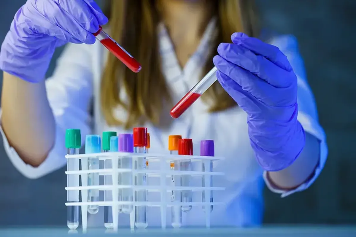 A blood test can reveal which organs are aging fastest 3 Scientists know which organs in the human body are likely to fail first.