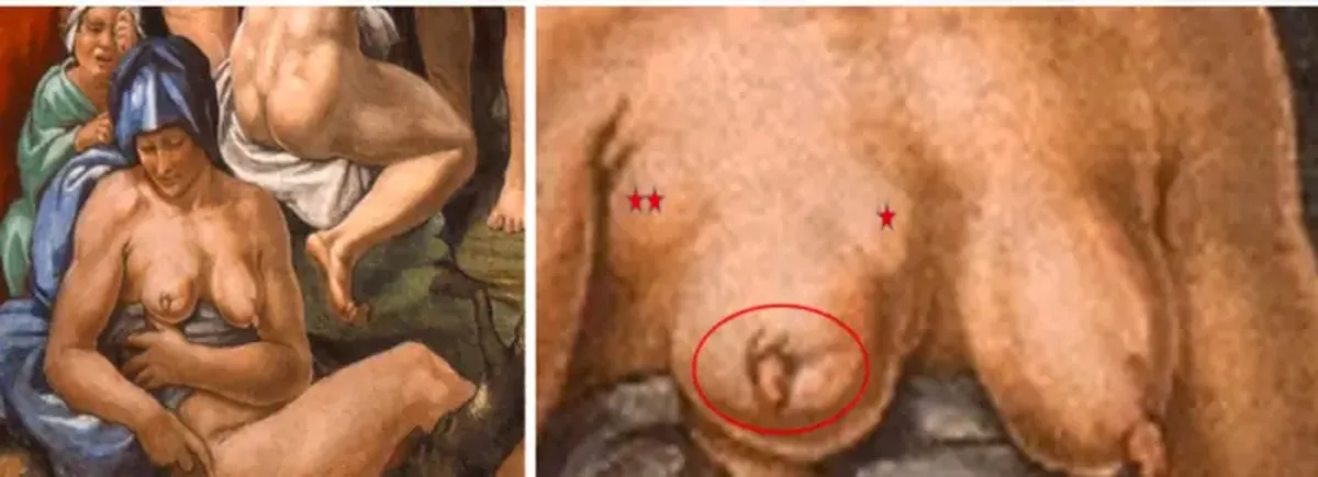 The Sistine Chapel's Hidden Diagnosis: Michelangelo Painted a Woman with Terminal Breast Cancer 4 The secret of the Sistine Chapel: a woman in Michelangelo's fresco has been diagnosed with a terminal illness.