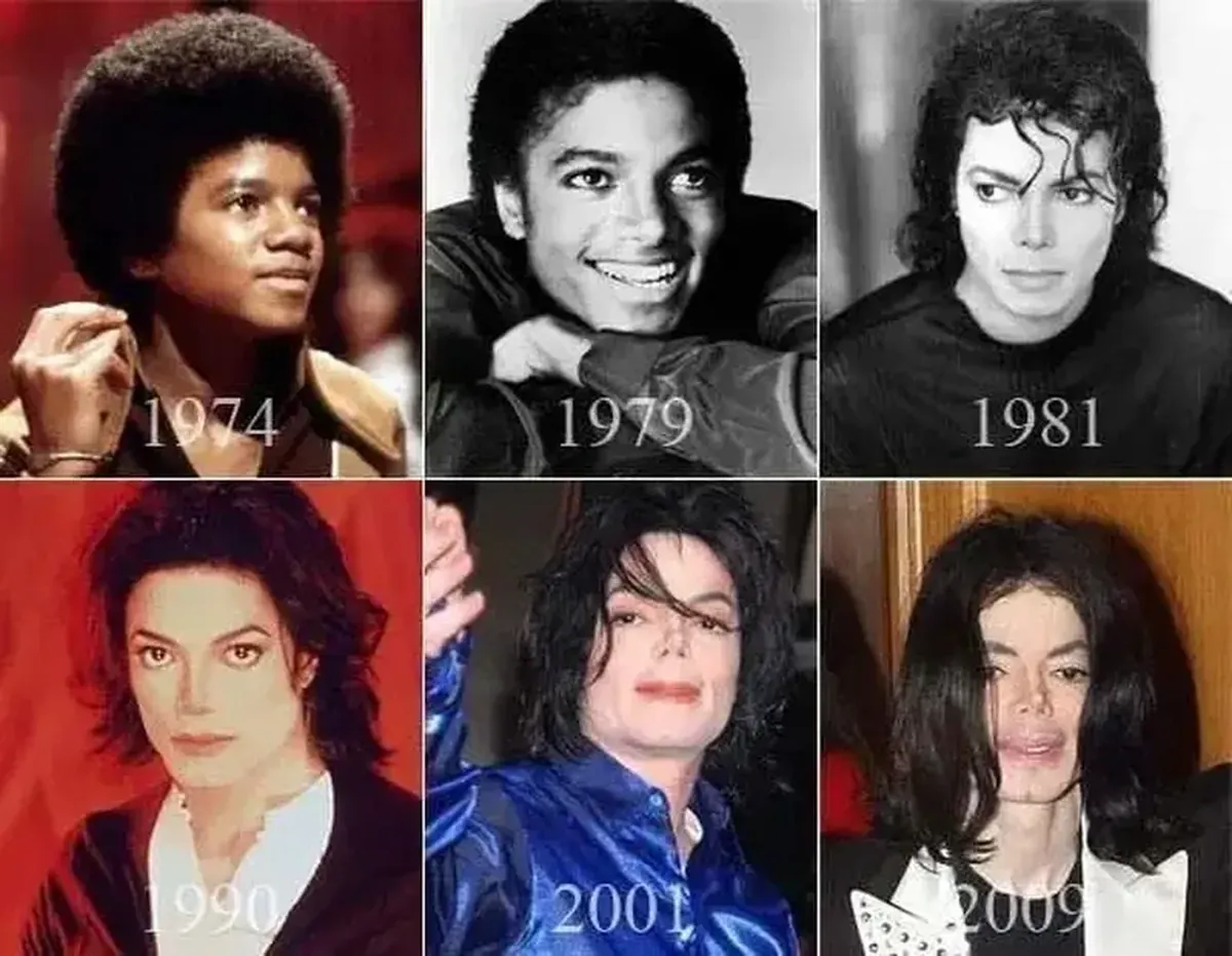 Michael Jackson’s Mask: How Trauma, Fame, and Reinvention Shaped the King of Pop 9 Michael Jackson: The King in a Mask
