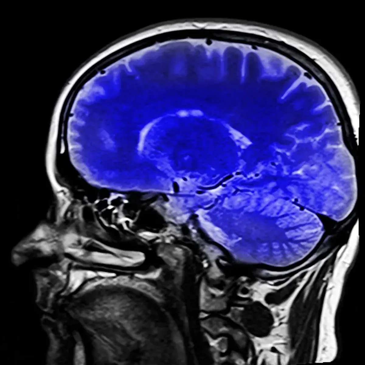 Seeing Nature Eases Pain — fMRI Shows It's Not Just a Placebo 3 According to scientists, observing the beauty of nature can alleviate pain.