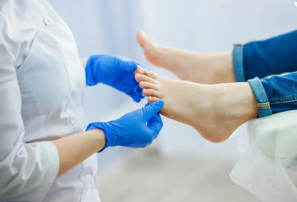 Mycosis. Nail examination by a doctor