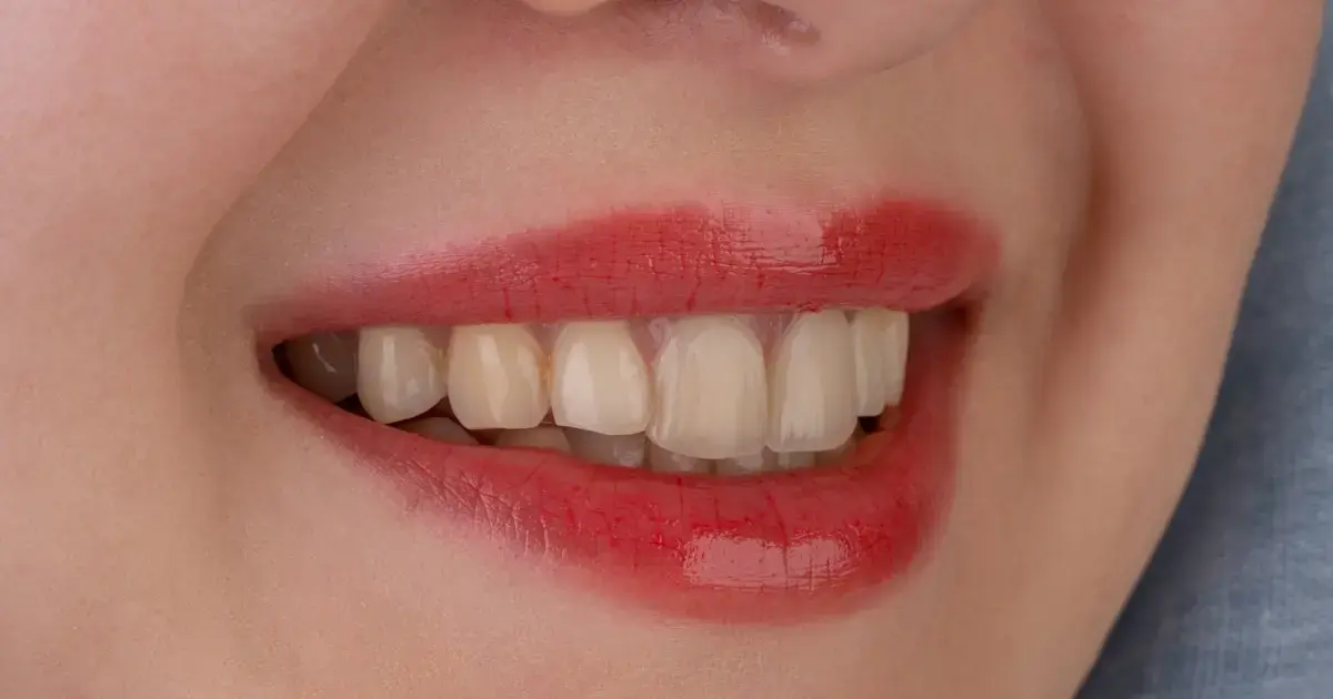 healthy teeth