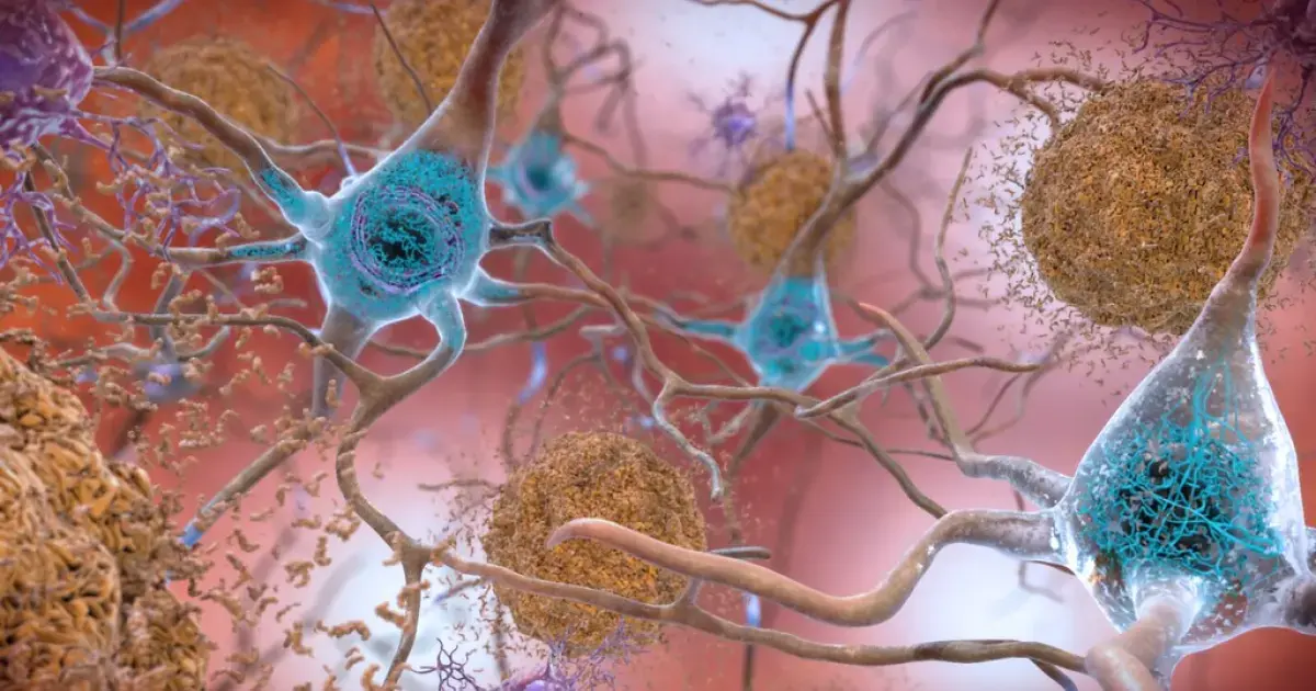 Tiny camel and llama nanobodies could protect the brain from dementia 4 tau proteins and beta-amyloid