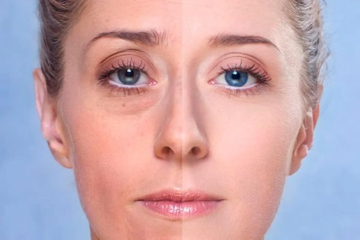 Dark Circles and Eye Bags Aren’t Just from Tiredness — Here’s What Else Causes Them 4 woman with and without under-eye bags