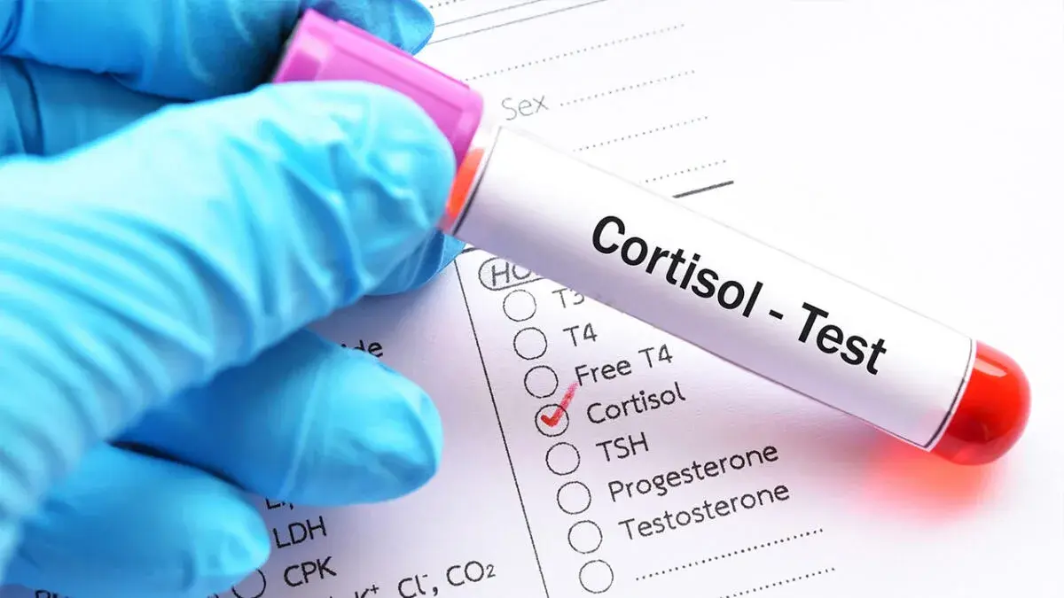 The Foods Secretly Causing Your Cramps and Body Pain 5 Cortisol Blood Test