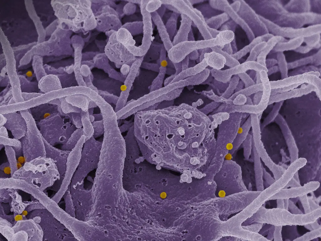 viruses in cells