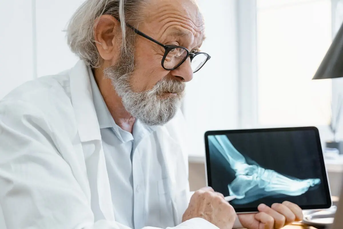 doctor holding an X-ray of a bone fracture
